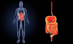 Cơ thể xuất hiện '1 đen, 1 đau và 2 mùi', có thể là ruột đang kêu cứu, đừng chậm trễ! 