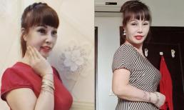 Khuôn miệng của 'cô dâu 62 tuổi' Thu Sao dần cân đối sau khi điều trị, được người quen khen 'đẹp không tỳ vết'