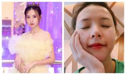 Midu tiết lộ từng giam mình một tháng, đăng luôn ảnh xấu nhất với mặt đầy mụn