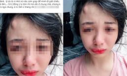 Cô gái bị chồng đánh đến 'u đầu' dù đã ly thân nhưng vẫn sống chung nhà, dân mạng khuyên nên chấm dứt việc nhập nhằng 