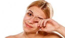 'Ngứa' 2 bộ phận trên cơ thể, đừng nghĩ là dị ứng, nó có thể liên quan đến bệnh gan, cần cảnh giác 