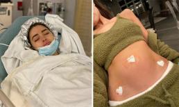 'Hoa hậu Hoàn vũ sexy nhất thế giới' Olivia Culpo phẫu thuật tử cung