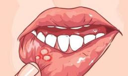 Ung thư phổi giai đoạn đầu không gây đau và ngứa. Nếu có 3 điểm bất thường trên da, có thể tế bào ung thư đang tiến đến, đừng bất cẩn