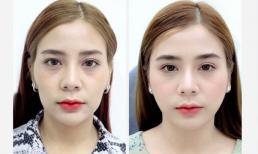 Tái sinh đa tầng - Đánh thức “vẻ đẹp xuân thì”