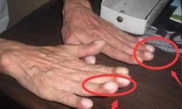 Nếu xuất hiện 4 “dị thường” này, phổi bắt đầu có bệnh, cần chú ý ung thư