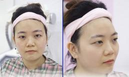 Đánh bay nám sau sinh nhờ bí quyết của bà mẹ 2 con