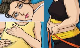 8 dấu hiệu cho thấy cơ thể bạn quá dư thừa estrogen, có thể gây ung thư vú