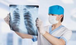 Cổ họng có phải là 'báo động' cho phổi? Nếu có 3 bất thường ở họng thì hầu hết phổi đã bị tổn thương