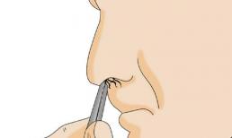 Điều gì sẽ xảy ra nếu bạn vô tình dùng nhíp nhổ lông mũi bị thò ra ngoài? Bác sĩ: Ba hậu quả phải gánh chịu