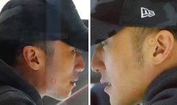 Từng phải phẫu thuật vì ung thư da, Tạ Đình Phong gây lo lắng khi xuất hiện nhiều dấu vết lạ trên mặt