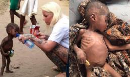 Cậu bé da đen 2 tuổi bị bỏ đói đến gầy trơ xương trong bức ảnh từng khiến hàng triệu người rơi nước mắt bây giờ ra sao?