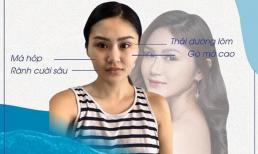 'Cải lão hoàn đồng' trẻ ra 10 tuổi nhờ phương pháp làm đẹp đa công nghệ hot nhất