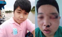 Lộ hình ảnh bầm dập, sưng húp mặt mũi của nam thanh niên Tây Ninh xúc phạm cố NS Chí Tài, nghi do bị đánh?