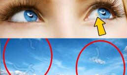 12 điều mắt có thể nói về sức khỏe của bạn