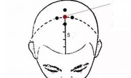 Hãy ghi nhớ 5 điểm này để ngăn ngừa rụng tóc nhé! 