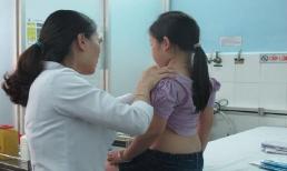 Bé gái 6 tuổi ở Hà Nội dậy thì sớm, 2 bên ngực to bất thường