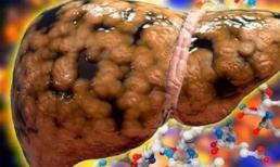 Đây là những gì sẽ xảy ra với cơ thể bạn khi uống nước chanh hàng ngày 