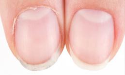 Tại sao móng tay mọc nhanh hơn móng chân? Bác sĩ nổi tiếng của Mỹ giải thích qua quan sát và ghi chép trong 35 năm liên tục