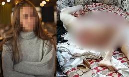 Cô gái 20 tuổi bị 10 con chó hoang tấn công điên cuồng, gương mặt bị cắn đến mức không thể nhận ra 