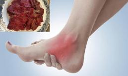 Hai loại thịt được mệnh danh là 'bình chữa cháy' cho bệnh gút, ăn điều độ còn giúp bảo vệ xương khớp, bổ sung canxi
