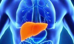 Bệnh xơ gan cổ trướng thường có 3 thay đổi trên đầu, bạn hãy cố gắng chú ý 