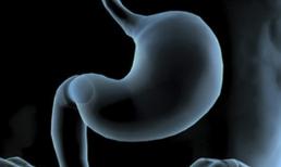 Dạ dày không tốt, thường xuyên ăn 4 loại trái cây, có thể dưỡng ruột và dạ dày, giúp tiêu hóa, nâng cao khả năng miễn dịch