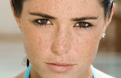 Tại sao ngày càng có nhiều vết nám trên mặt? 5 nguyên nhân này sẽ khiến bệnh phát triển rầm rộ, vì vậy hãy hết sức cảnh giác