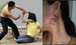 Cô gái bị 'mua về' chỉ để đẻ, đòi bỏ là chồng đánh