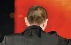 Bạn có bị hói không? Việc bạn cần làm lúc này là: bổ sung 3 dưỡng chất này càng sớm thì càng tốt