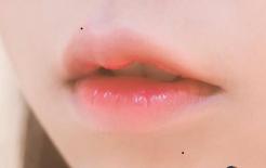  Ba nốt ruồi tốt lành này trên cơ thể sẽ khiến bạn giàu có cả đời, lỡ xóa sẽ hối hận