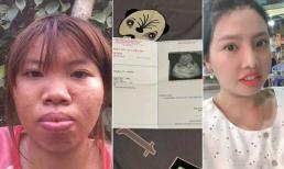 Hơn 1 tháng sau đám cưới, 'Thị Nở tái sinh' Quách Phượng thông báo tin vui đang mang bầu 14 tuần 