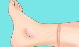 7 dấu hiệu cảnh báo rằng bạn đang bị mắc bệnh tim 