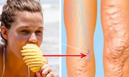 6 loại thực phẩm rẻ tiền giúp làm sạch cơ thể một cách tự nhiên