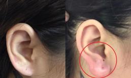 Nữ doanh nhân vào spa làm 'tai Phật' để cải thiện tướng số, đổi vận đâu chưa thấy đã nhận lấy 'trái đắng'