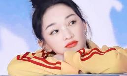 Châu Tấn bị chấn thương ở mũi, nghe xong nguyên nhân ai nấy đều cười té ghế 