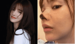 Nhan sắc người đẹp Trung Quốc trước khi phẫu thuật mũi thành 'đỉnh núi nhọn hoắt' khiến fan tiếc nuối