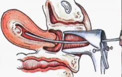 Những thói quen tự 'làm hỏng' tử cung của phụ nữ! Hút thuốc xếp cuối, đầu bảng là vấn đề chung nhiều bạn trẻ đang mắc