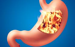 Ợ chua là gì? Tôi sẽ chia sẻ cho bạn 5 mẹo để tự chữa bệnh mà không cần dùng thuốc cũng có thể thuyên giảm