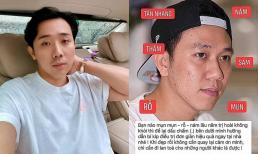 Thấy Anh Đức bị kẻ gian lợi dụng hình ảnh quảng cáo, Trấn Thành nổi giận nhờ netizen đánh sập trang fanpage giả mạo