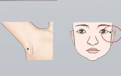 5 nốt ruồi 'điềm lành', nam thì thăng quan tiến chức, nữ thì vượng phu 