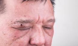 Tại sao rất nhiều bệnh nhân giang mai đều là người cao tuổi? Bác sĩ cho biết lý do, nó ở ngay bên cạnh bạn