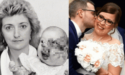 Sinh ra với khối u biến dạng, cô bé bị hàng xóm mỉa mai chỉ trỏ suốt thời thơ ấu để rồi 'vịt hóa thiên nga' trong ngày cưới