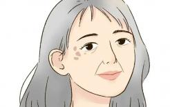 5 nguyên nhân chính gây ra nám, tàn nhàng và các đốm trên mặt thường gặp