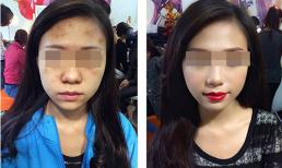 Chứng kiến từ A - Z cảnh người yêu tẩy trang, chàng trai muốn chia tay luôn và tự hỏi: 'Có phải mình bị lừa rồi không?'