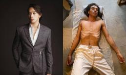 Thuận Nguyễn chính thức lên tiếng trước hình ảnh gầy trơ xương