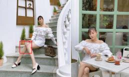 Khoe vai trần, chân thon nhưng lại lộ vết sẹo thâm ở đầu gối, Phương Oanh nói gì?