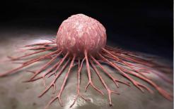 'Có ung thư trong người, trong bụng sẽ tiên chi'? Nếu trong bụng có 3 biểu hiện này thì có thể liên quan đến bệnh ung thư