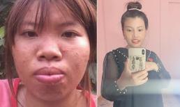 'Thị Nở tái sinh' Quách Phượng đăng ảnh bụng bầu lùm lùm, gương mặt 'dao kéo' liệu có bị vỡ nét khi mang thai?