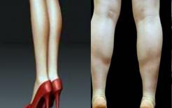 Làm thế nào để loại bỏ cơ chân? 2 bài tập và 1 kỹ thuật để kéo dài sợi cơ, thon gọn bắp chân