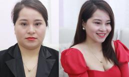 Bắt kịp xu hướng làm đẹp 2021: Nâng cơ, thon gọn gương mặt không cần phẫu thuật